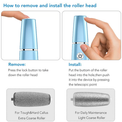 🔥Last Day Promotion 50% OFF🔥 USB Rechargeable Feet Repair and Grinding Device