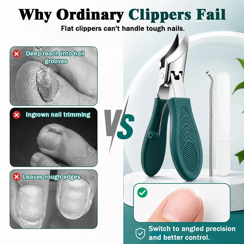 Eagle Beak Angled Nail Clippers 3-Piece Set (With Nail Lifter & File) — Podiatrist-Grade Thick & Ingrown Toenail Trimmer 🦶✂️ (JG)